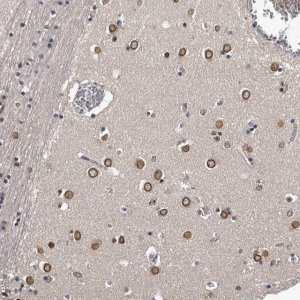 Anti-C1orf50 antibody produced in rabbit 
