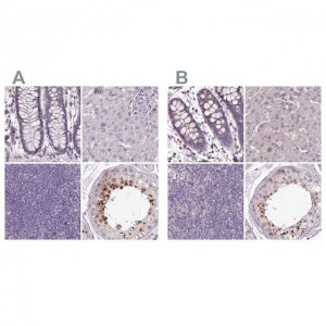 Anti-C1orf56 antibody produced in rabbit 