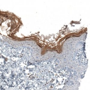 Anti-C1orf68 antibody produced in rabbit 