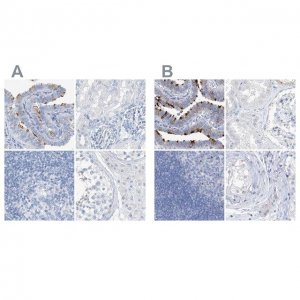 Anti-C1orf87 antibody produced in rabbit 