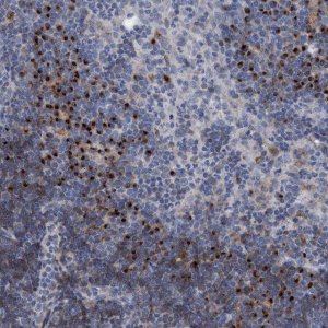 Anti-C20orf196 antibody produced in rabbit 