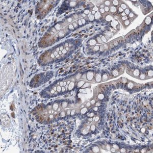Anti-C20orf196 antibody produced in rabbit 