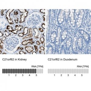 Anti-C21orf62 antibody produced in rabbit 