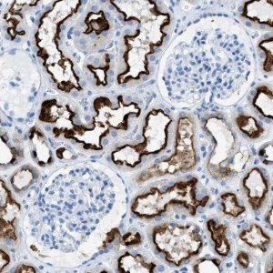 Anti-C21orf62 antibody produced in rabbit 