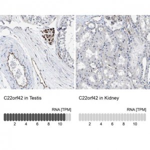 Anti-C22orf42 antibody produced in rabbit 