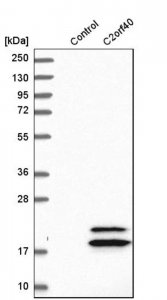 Anti-C2orf40 antibody produced in rabbit 