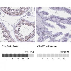 Anti-C2orf70 antibody produced in rabbit 