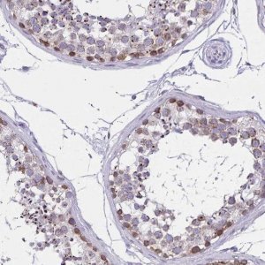 Anti-C2orf70 antibody produced in rabbit 