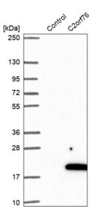 Anti-C2orf76 antibody produced in rabbit HPA044977-100UL