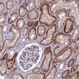 Anti-C2orf76 antibody produced in rabbit HPA044977-100UL