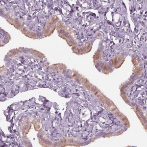 Anti-C2orf81 antibody produced in rabbit 