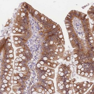 Anti-C2ORF88 antibody produced in rabbit 