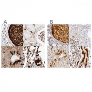 Anti-C4BPA antibody produced in rabbit 