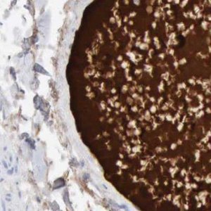 Anti-C4BPA antibody produced in rabbit 