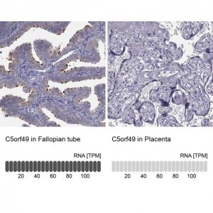 Anti-C5ORF49 antibody produced in rabbit 