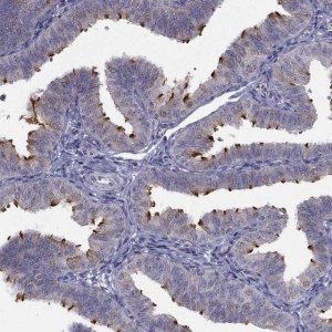 Anti-C5ORF49 antibody produced in rabbit 