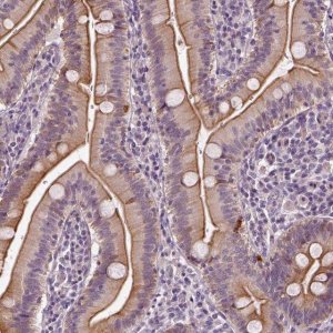 Anti-C6orf106 antibody produced in rabbit HPA034490-100UL