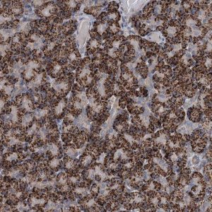 Anti-C6orf120 antibody produced in rabbit 