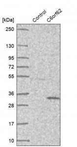 Anti-C6orf62 antibody produced in rabbit HPA030564-100UL