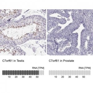 Anti-C7orf61 antibody produced in rabbit 