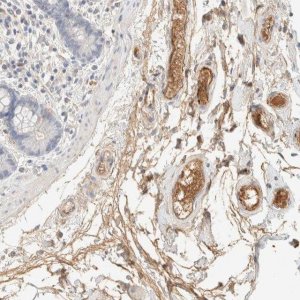Anti-C8B antibody produced in rabbit HPA023694-100UL