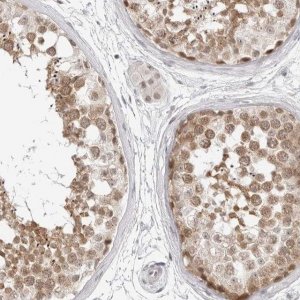 Anti-C8orf48 antibody produced in rabbit HPA026107-100UL