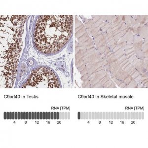 Anti-C9orf40 antibody produced in rabbit 