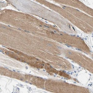 Anti-CA14 antibody produced in rabbit 