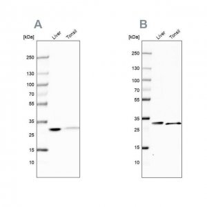 Anti-CA3 antibody produced in rabbit HPA021775-100UL