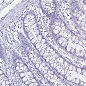 Anti-CA9 antibody produced in rabbit 