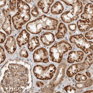 Anti-CAAP1 antibody produced in rabbit HPA024029-100UL
