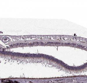 Anti-CABP5 antibody produced in rabbit 
