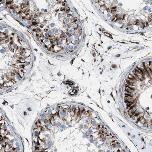 Anti-CABP7 antibody produced in rabbit 