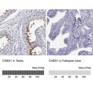Anti-CABS1 antibody produced in rabbit 