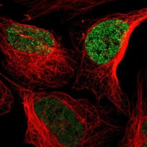 Anti-CACFD1 antibody produced in rabbit 