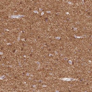 Anti-CACNA1A antibody produced in rabbit 