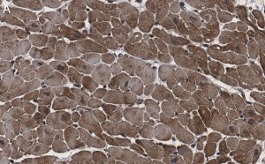 Anti-CACNA1C Antibody, clone 1F20 ZooMAb Rabbit Monoclonal 