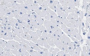 Anti-CACNA1C Antibody, clone 1F20 ZooMAb Rabbit Monoclonal 