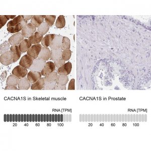Anti-CACNA1S antibody produced in rabbit 