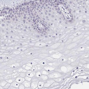 Anti-CACNA1S antibody produced in rabbit 