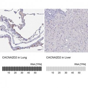 Anti-CACNA2D2 antibody produced in rabbit 