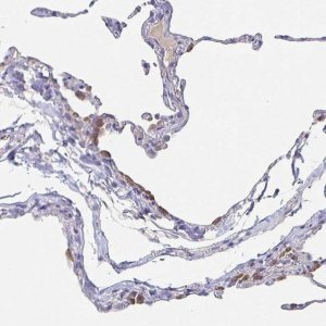 Anti-CACNA2D2 antibody produced in rabbit 