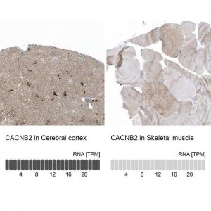 Anti-CACNB2 antibody produced in rabbit 
