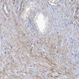 Anti-CACNB2 antibody produced in rabbit 
