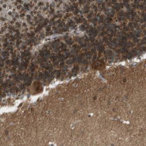 Anti-CACNB4 antibody produced in rabbit 