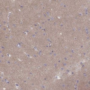 Anti-CACNG4 antibody produced in rabbit 