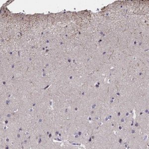 Anti-CACNG8 antibody produced in rabbit 