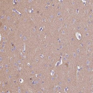 Anti-CADPS antibody produced in rabbit 