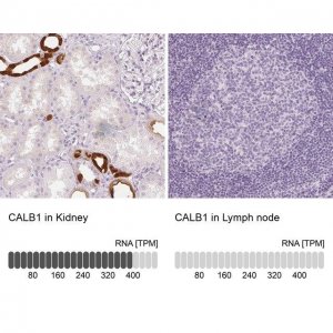 Anti-CALB1 antibody produced in rabbit 