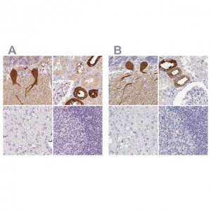 Anti-CALB1 antibody produced in rabbit 